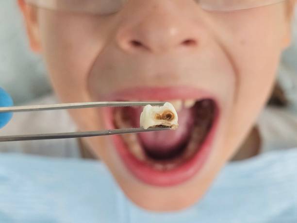 Best Pediatric Emergency Dentist in Rushford, MN